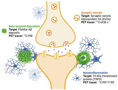 ASIC-E4: Interplay of Beta-Amyloid, Synaptic Density and Neuroinflammation in Cognitively Normal Volunteers With Three Levels of Genetic Risk for Late-Onset Alzheimer's Disease – Study Protocol and Baseline Characteristics